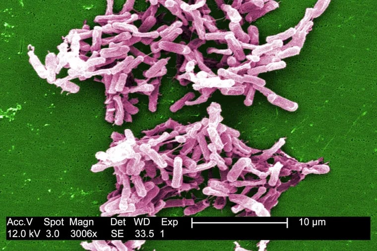 This micrograph depicts Gram-positive C. difficile bacteria from a stool sample culture. People can become infected if they touch something contaminated with feces and then touch their mouth or eyes.