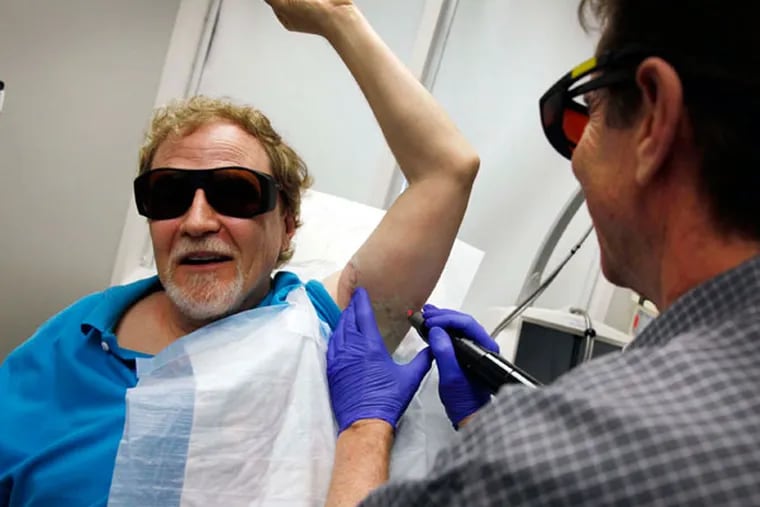 Wearing dark glasses to protect their eyes, Dr. Gary P. Lask at UCLA uses a specialized laser to remove a tattoo from the arm of patient Stuart Yellin. This latest laser procedure, approved by the U.S. Food and Drug Administration in 2012, delivers super-short energy bursts to the skin, substantially shorter than the industry standard nanosecond equipment.