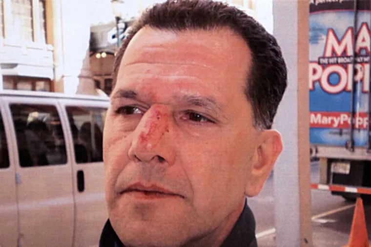 Parking Enforcement Officer Ken Giusini, who was punched by an irate ticket recipient.