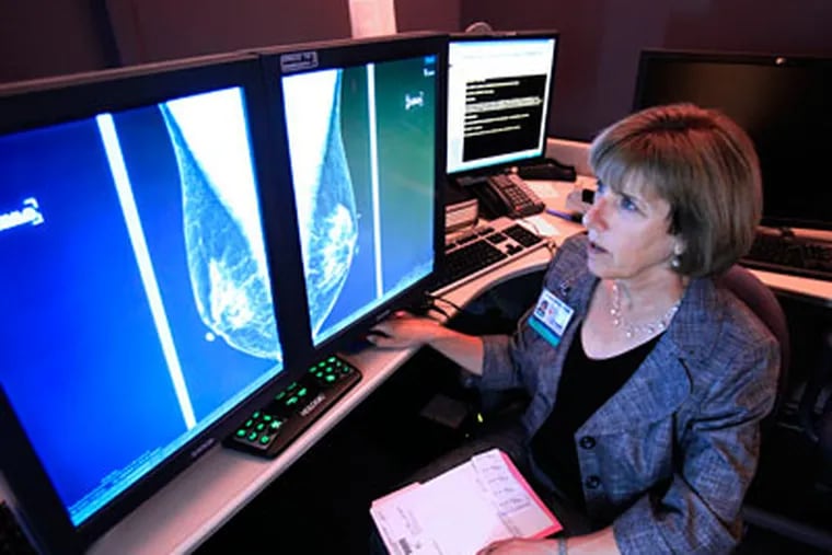 Dr. Karen Lindsfor, a professor of radiology and chief of breast imaging at the University of California, Davis Medical Center, examines a  mammogram. Women concerned about breast cancer should worry less about cellphones and hair dyes and worry more about weighing or drinking too much and exercising too little, according to a new study. (AP Photo/Rich Pedroncelli)