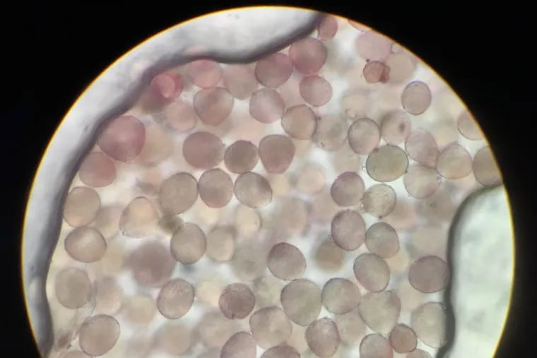 Oak pollen from May 4, 2018. Taken from a sample collected by The Asthma Center at 205 N. Broad Street, Philadelphia.