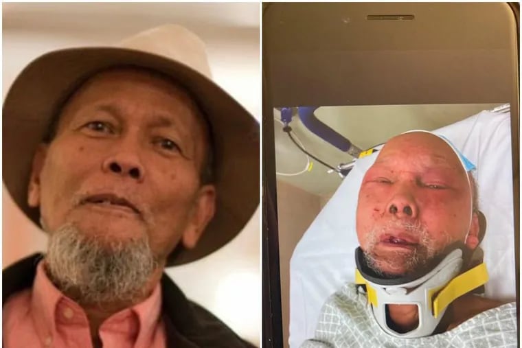 Mauricio Gesmundo Sr., 83, died Monday from injuries sustained in a beating during a robbery in his Hunting Park home on New Year's Eve. He is seen before (left) and shortly after the attack. A few days after the assault, he fell into a coma and never recovered, his family said.