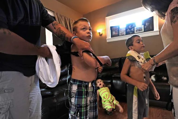 Jeff Leider, far left, shows Jason's, 8, scar from his most recent surgery as Deena Ledier, right, puts Justin's, 6, shirt back on after showing the IV of medications both boys receive on July 13, 2015 in Elmwood Park, N.J. Both boys have Hunter sydrome, a rare genetic disease that causes damage to the brain. (Danielle Parhizkaran/The Record/TNS)
