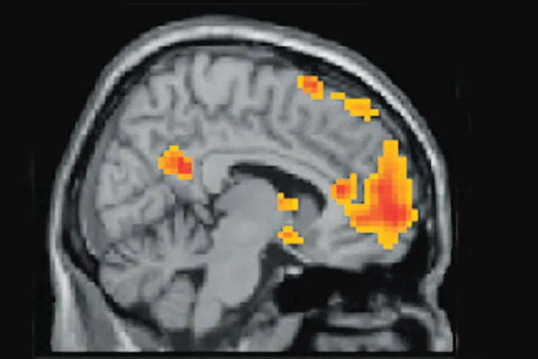 A brain image provided by Emily Falk's team. (handout)