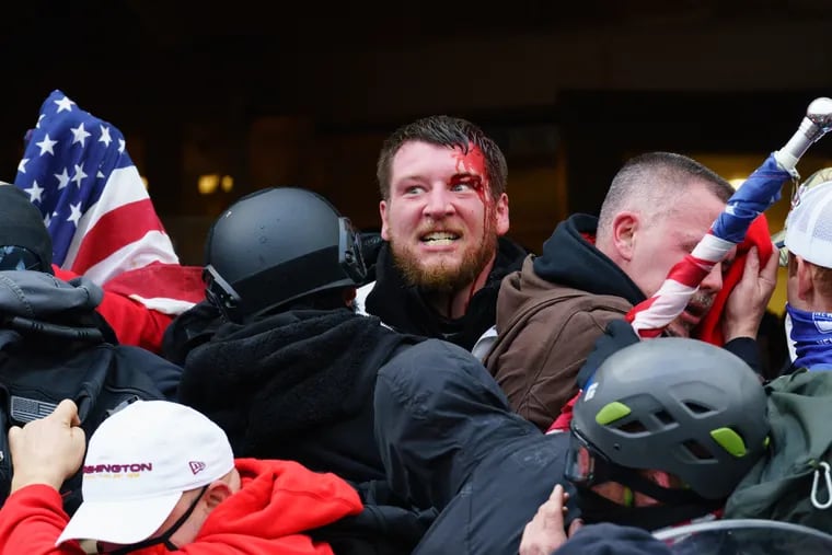 A Trump supporter is bleeding after an injury sustained while trying to push past police through the doorway of the Capitol, in Washington, Wednesday, Jan. 6, 2021.