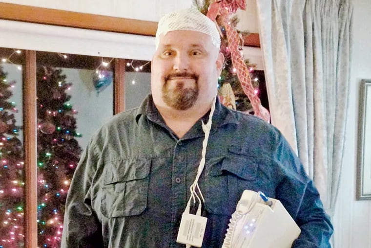 Michael Coleman, 46, of Lock Haven, Pa., has worn the Optune device for four years to battle tumors. As of now, his brain scans are clear.