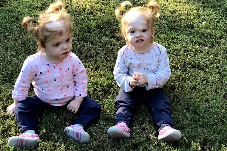In October, Abby (left) and her twin sister Erin sat on the lawn at their grandparent's house in North Carolina