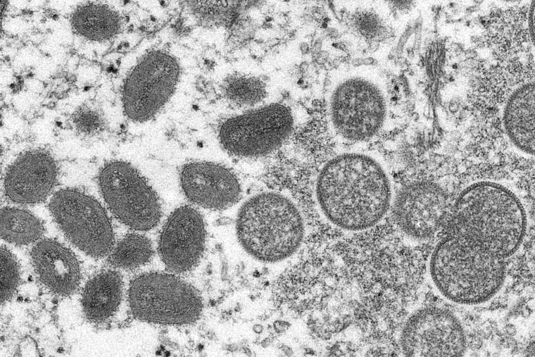 A 2003 electron microscope image shows mature, oval-shaped monkeypox virions, left, and spherical immature virions, right, obtained from a sample of human skin associated with the 2003 prairie dog outbreak.