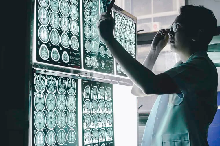 This MRI film showed this brain atrophy indicates dementia.