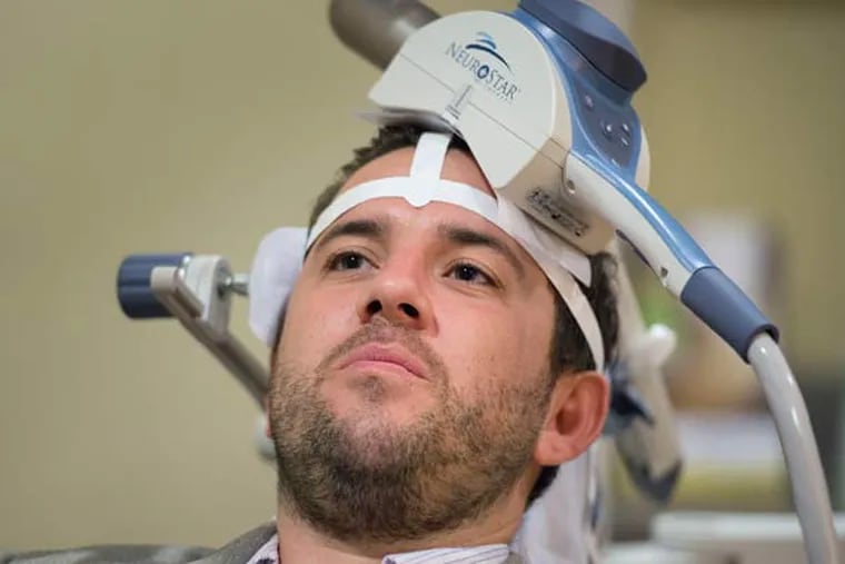 31-year-old Nicholas O'Madden, who suffers from anxiety and depression, receives treatment with Transcranial Magnetic Stimulation (TMS) therapy, which uses a large magnet to stimulate certain parts of the brain to alleviate depressive symptoms at TMS Health Solutions on July 2, 2015 in Sacramento, Calif. (Randy Pench/Sacramento Bee/TNS)