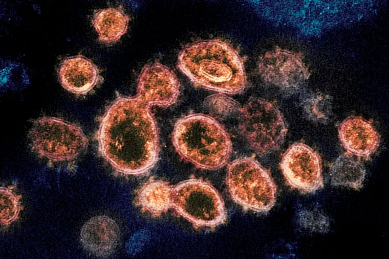 This transmission electron microscope image shows SARS-CoV-2, the virus that causes COVID-19, isolated from a patient in the U.S.
