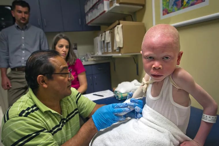 At Shriners Hospital, Baraka Cosmas Rusambo, 6, among the mutilated because of albinism, gets a fitting. (ALEJANDRO A. ALVAREZ/Staff Photographer)