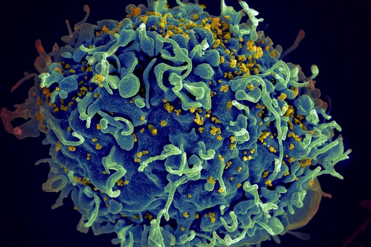A microscopic image of HIV attacking an immune cell. A HIV vaccine trial ended early this January after failing to demonstrate effectiveness.