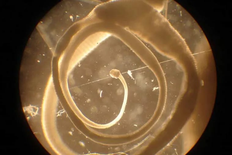 The adult stage of "Hymenolepis diminuta," a small helminth. The worm is used therapeutically only in its larval stage.