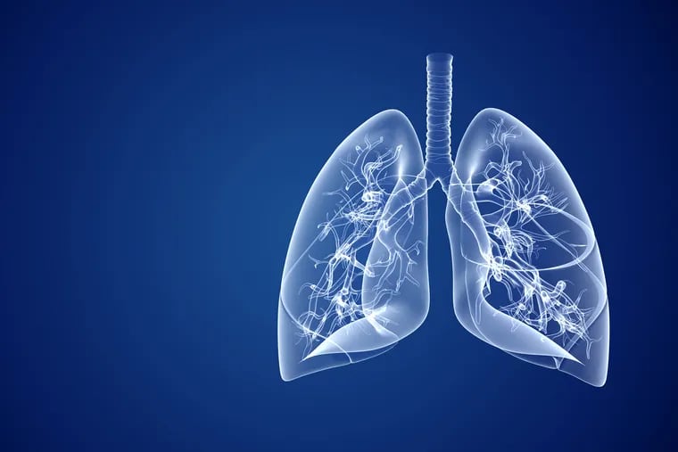 Lung imaging can show potential signs of MAC infection, but a sputum test to confirm the presence of bacteria is the only way to definitively diagnose MAC lung disease.