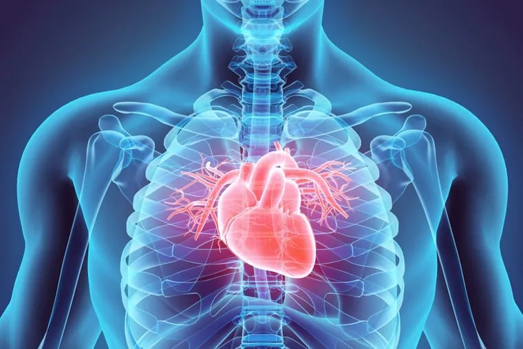 Is chest pain the main warning signal of a heart attack? Think again.