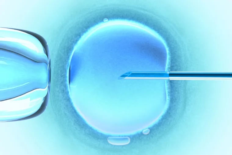 “Minimal stimulation IVF” aims to ripen no more than a handful of eggs. Industry professional organizations say it can benefit several types of patients including women at risk of dangerous ovarian hyperstimulation syndrome. Yet it has not caught on in this country.