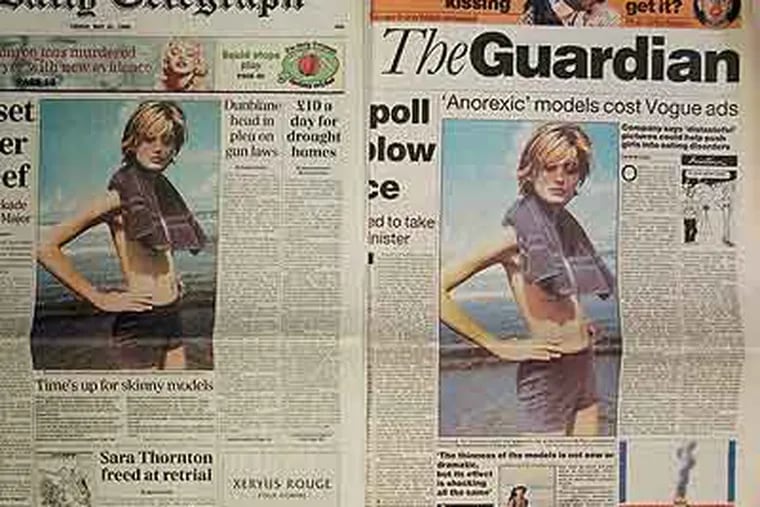 A selection of British broadsheets from 1996, protesting waif-like models from a Vogue magazine issue. A new study led by Drexel researchers suggests weight history offers clues to chances for recovery. (AP Photo / John Parkin)
