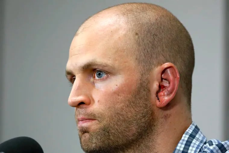 Toronto Blue Jays pitcher J.A. Happ attends a news conference prior to the Blue Jays' baseball game against the Tampa Bay Rays, Wednesday, May 8, 2013, in St. Petersburg, Fla. Happ was released Wednesday from a hospital, the day after he was hit on the head hit by a line drive from Tampa Bay Rays' Desmond Jennings. (AP Photo/Mike Carlson)