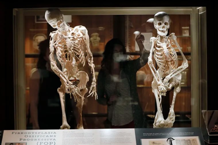 Guests examine two skeletons of people who had fibrodysplasia ossificans progressiva at the Mütter Museum of the College of Physicians of Philadelphia on Sept. 9, 2020.