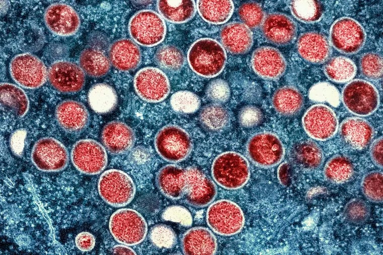 A color enhanced image of monkeypox particles and infected cells. As of August 1, 2022 nearly 6,000 cases of the virus have been identified in the U.S. as part of a global outbreak.