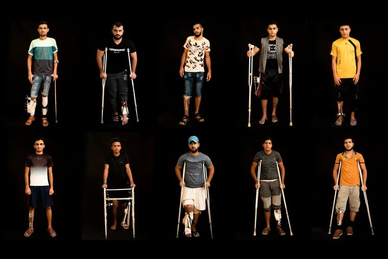 In this combination of 10 photos taken on Sept. 19, 2018, Palestinians shot in the legs during demonstrations at the Gaza strip's border with Israel pose as they await treatment at a Gaza City clinic run by MSF (Doctors Without Borders). Israeli forces deployed along the volatile border have fired live rounds at rock-throwing Palestinian protesters since demonstrations began in March against Israel's long-running blockade of Gaza. Israeli snipers have targeted one part of the body more than any other: the legs. (AP Photo/Felipe Dana)