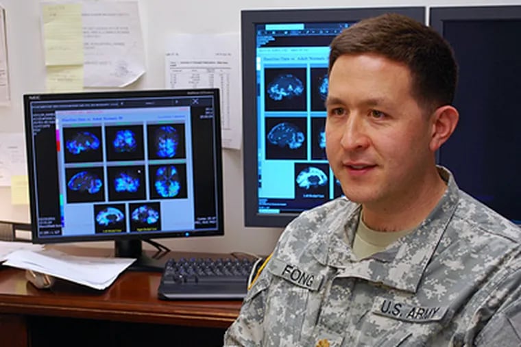 Andrew Fong, chief of radiology at Fort Campbell, Ky., describes the brain scans. “What’s interesting here is that we are seeing things here that we can’t see in their standard CT scan.” (Kristin M. Hall / Associated Press )