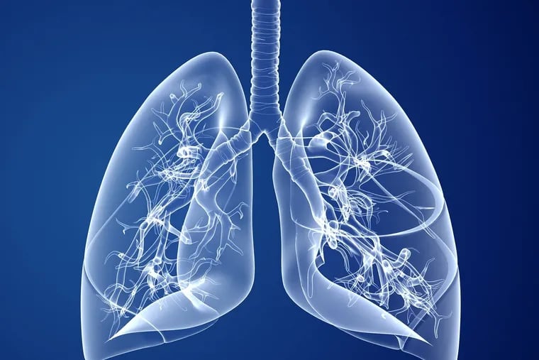 With COPD, air gets trapped in the lungs, which leads to a patient feeling as though they cannot breathe.