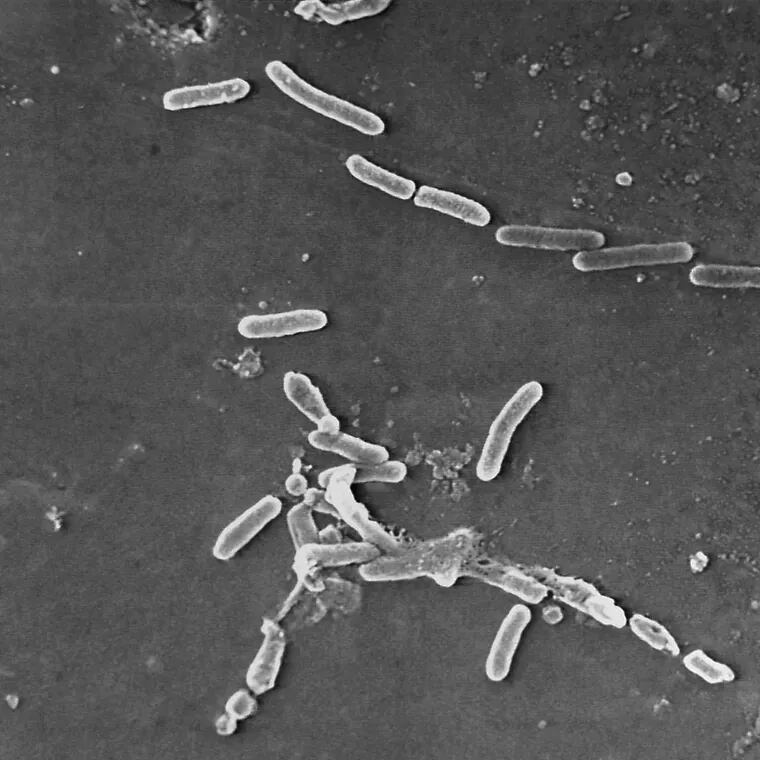 A microscopic image of Pseudomonas aeruginosa, the drug-resist bacteria that has been causing eye infections in people who used now-recalled eye drops.