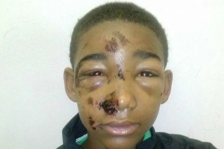 Joseph Williams, 14, was zapped by cops while fleeing arrest.
