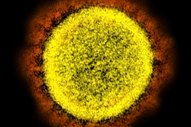 This 2020 electron microscope image made available by the National Institute of Allergy and Infectious Diseases shows a Novel Coronavirus SARS-CoV-2 particle in a laboratory in Fort Detrick, Md. (NIAID/NIH via AP)