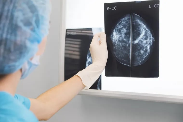 3-D mammograms are touted as being more accurate than conventional tests. But does that mean they catch more cancers that would have proven fatal?
