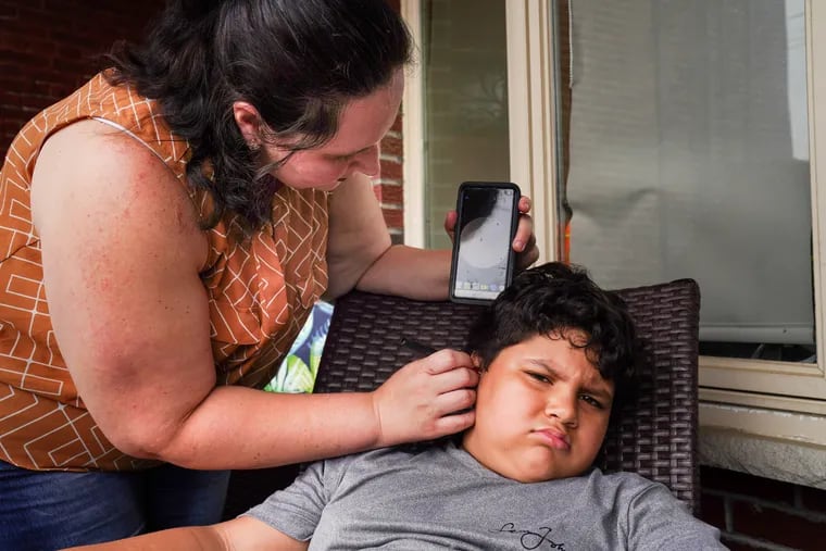 Georgina Rupnarine demonstrates an app and camera that she uses to view the inside of her son Ryan's ear and ear tubes, saying that the device is very helpful for cleaning the ears. Ryan, 7, suffered through a year and a half of monthly ear infections.