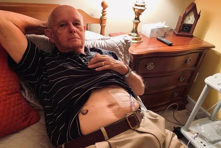 Jack Reynolds has been doing peritoneal dialysis at home in Dublin, Ohio, seven days a week for the past 3½ years. Before he goes to bed, he hooks up to the dialysis machine, which runs for 7.5 hours.