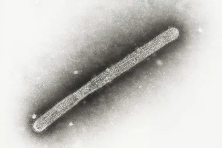 This 2005 electron microscope image shows an avian influenza A H5N1 virion. A second human case of the flu that has infected birds and cattle across the country was identified in Michigan Wednesday.