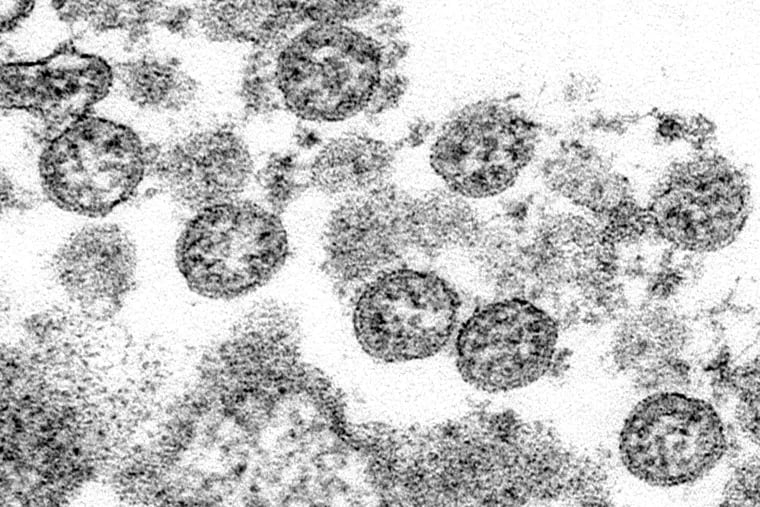 This 2020 electron microscope image made available by the U.S. Centers for Disease Control and Prevention shows the spherical coronavirus particles from what was believed to be the first U.S. case of COVID-19.