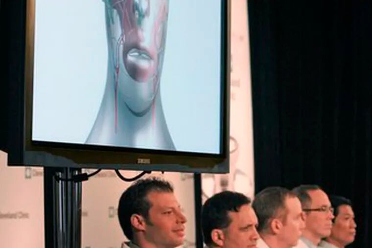 An animation of the face transplant is screened as Cleveland Clinic doctors describe the procedure at a news conference.