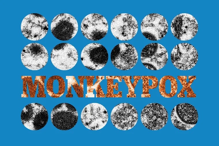 Images of the monkeypox virus.