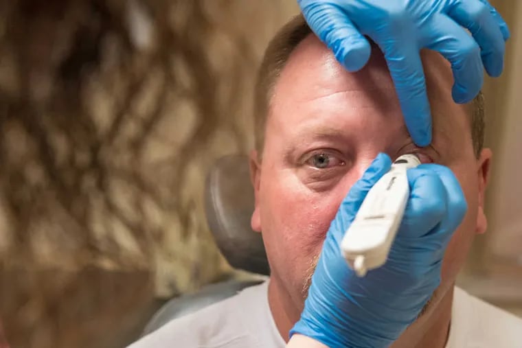Ocular melanoma patient Ed Tuggle receives a painless last check of his eye pressure before the laser activates the cancer drug, made of virus-like particles that home in on the tumor.