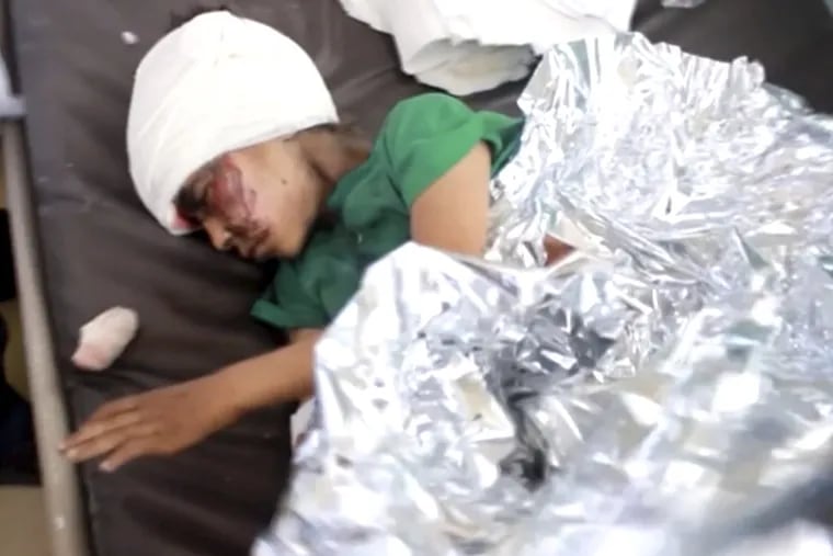 This image made from video taken on Thursday, Aug. 9, 2018, shows a child injured in an airstrike resting at a hospital in Saada, Yemen. Yemen's Shiite rebels are backing a United Nations' call for an investigation into a Saudi-led coalition airstrike in the country's north that killed dozens of people the previous day, including many children.