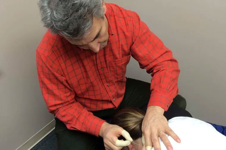 Mark Valente, a physical therapist in Woodstown, N.J., demonstrates the pain-management technique of dry needling.
