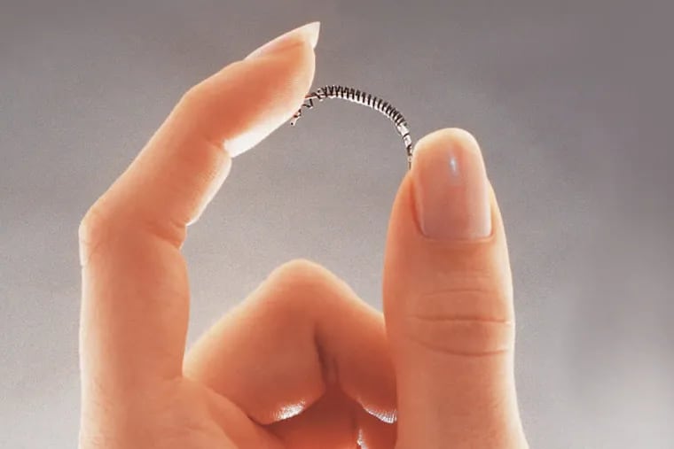 STERILIZ05 ——— Essure coils are inserted in the fallopian tubes to scar them shut.