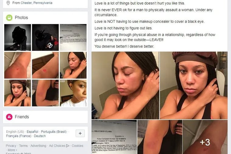 Aigner Cleveland, press secretary for the mayor of Chester, described on Facebook what she said were assaults committed against her by NBC10 reporter Dray Clark.