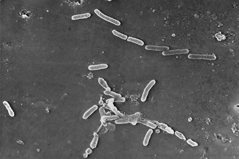 A microscopic image of Pseudomonas aeruginosa, the drug-resist bacteria that has been causing eye infections in people who used now-recalled eye drops.