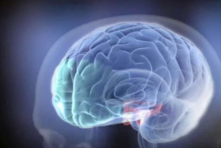 A new study found a relationship between obesity and signs of brain aging.