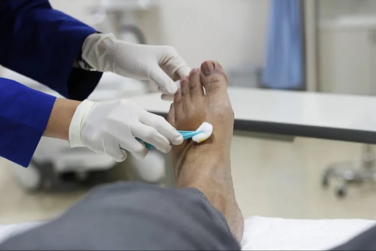 Foot ulcers are among the most dangerous complications of diabetes