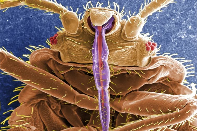 This digitally-colorized image of a bedbug from the U.S. Centers for Disease Control and Prevention. From this view you can see the insect’s skin piercing mouthparts it uses to obtain its blood meal, as well as a number of its six jointed legs.