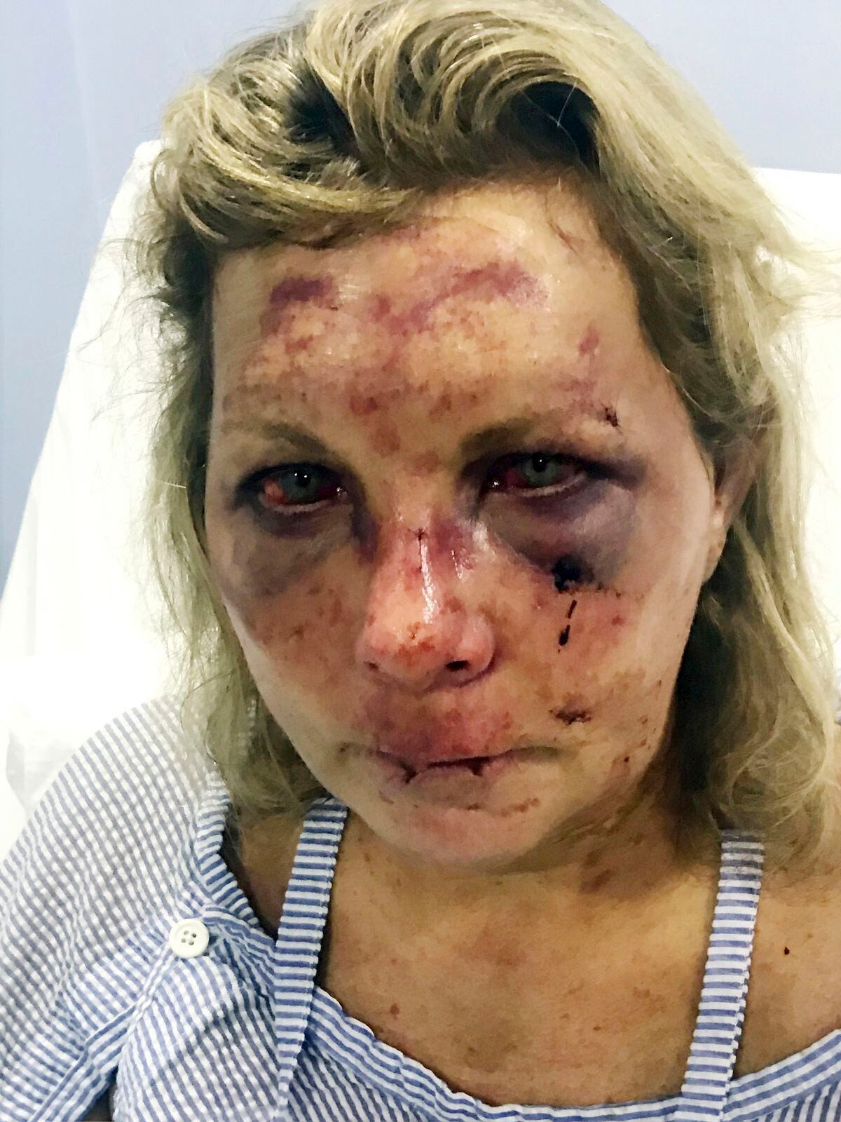 Dominican Police Investigating Attack On Delaware Woman At