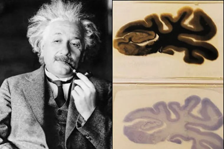The Mutter Museum has acquired slides of Einstein's brain.