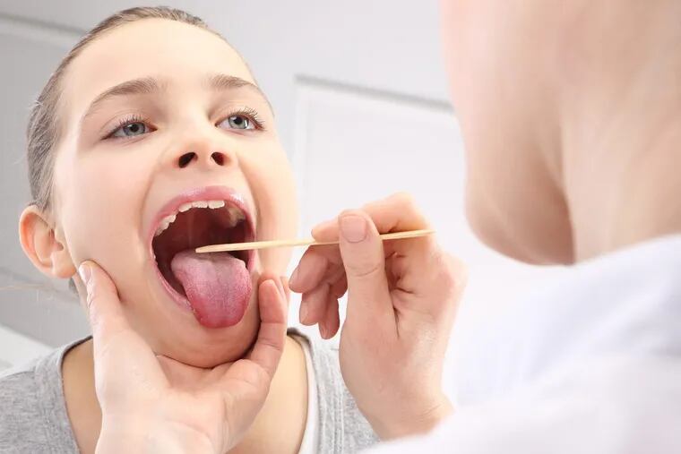 Teens and their tonsils: When do they need to be out?